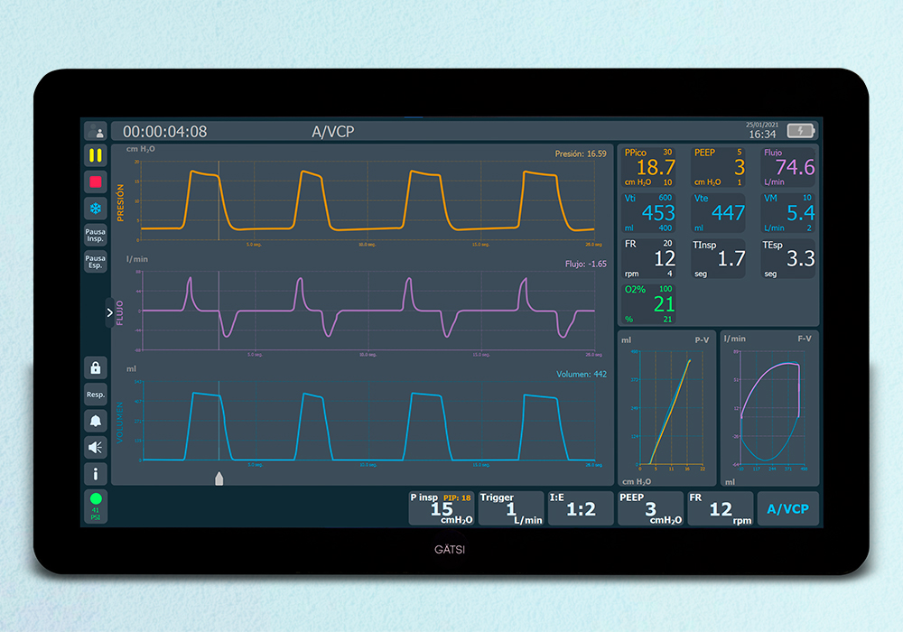 gatsi-ventilador-terapia-intensiva